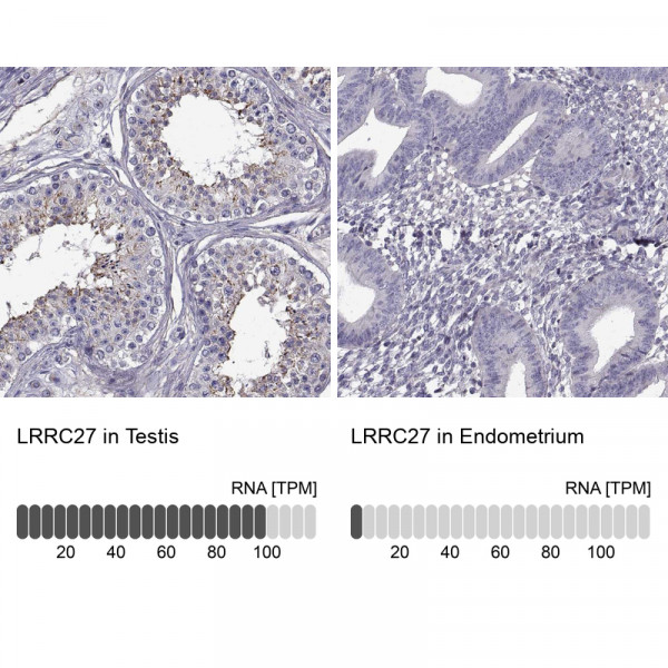 Anti-LRRC27
