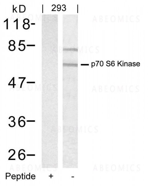 Anti-p70 S6 Kinase (Ab-389)
