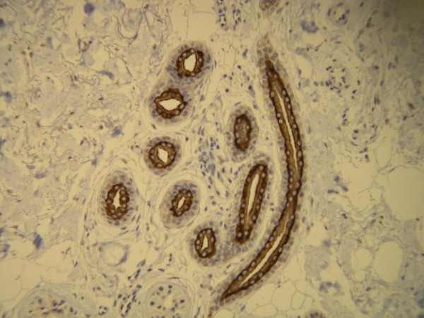Anti-Cytokeratin 16, clone R20-S