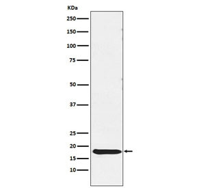 Anti-TSH beta / TSHB, clone AFDE-20