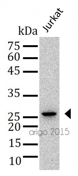 Anti-Bcl2, clone Bcl2/100/D5