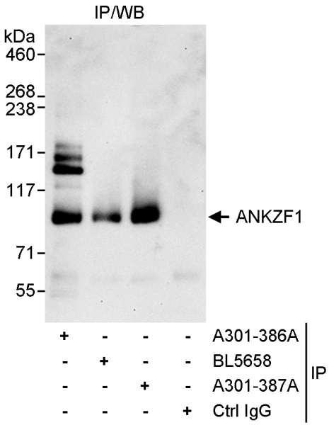 Anti-ANKZF1