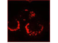 Anti-SARS-CoV Nonstructural Protein 13 (nsp13)