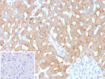Anti-HSD17B13 / Hydroxysteroid 17 beta dehydrogenase 13, clone HSD17B13/13105