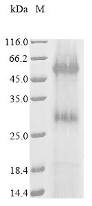 Lactose permease (lacY), partial, Escherichia coli, recombinant