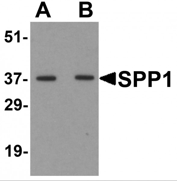 Anti-Osteopontin