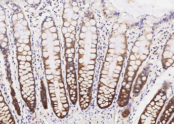 Anti-SRPK1 Monoclonal Antibody