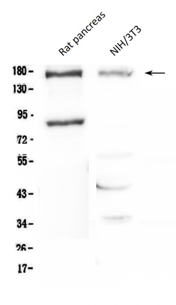 Anti-NPC1 / Niemann Pick C1