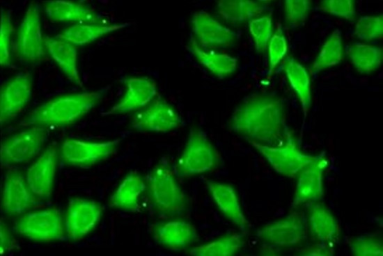 Anti-Myosin light chain 3