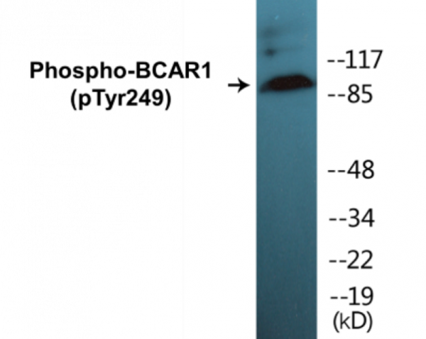 BCAR1 (Phospho-Tyr249) Colorimetric Cell-Based ELISA Kit