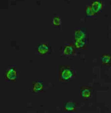 Anti-CD18 / LFA1 beta