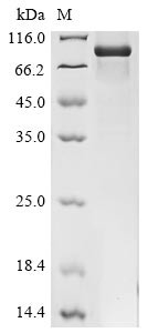 Pescadillo homolog (PES1), human, recombinant
