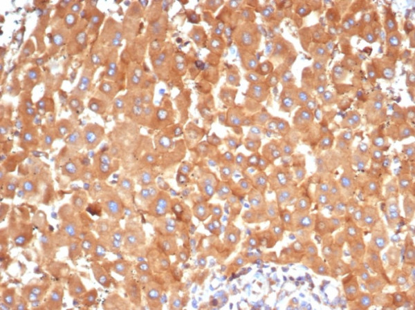 Anti-Alpha-2-Macroglobulin / A2M, clone A2M/6554