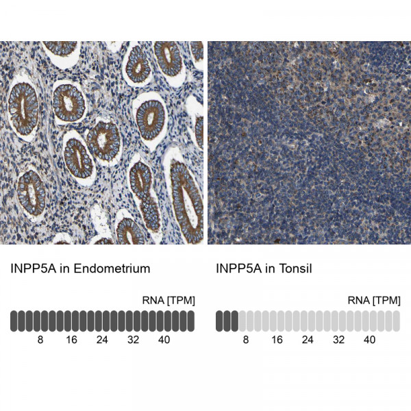 Anti-INPP5A