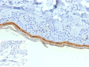 Anti-Filaggrin, clone r15C10