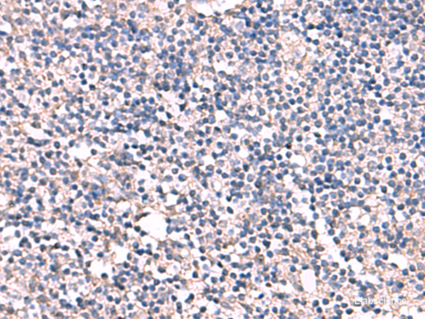 Anti-ESM1