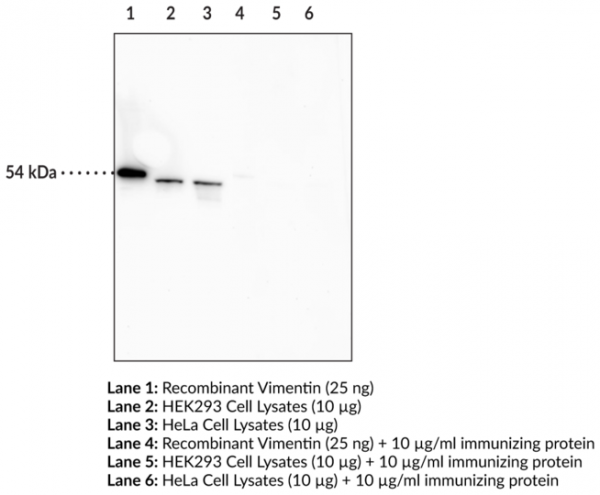 Anti-Vimentin (Clone 12E4)