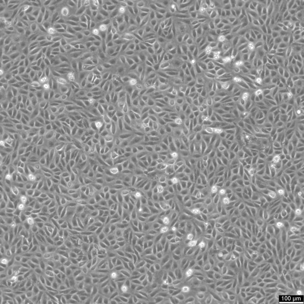 TPC-1 Cells