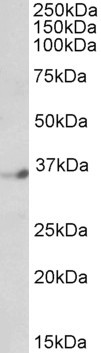 Anti-Neuro-d4 / DPF1, C-terminal