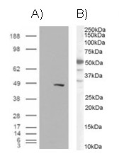 Anti-BAF57 / SMARCE1, C-terminal