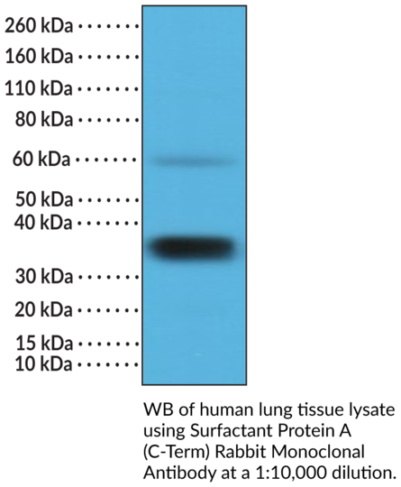 Anti-Surfactant Protein A (C-Term) Rabbit Monoclonal Antibody (Clone RM334)