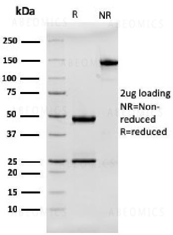 Anti-MUC2 (Mucin 2) Monoclonal Antibody (Clone: rMLP/842)
