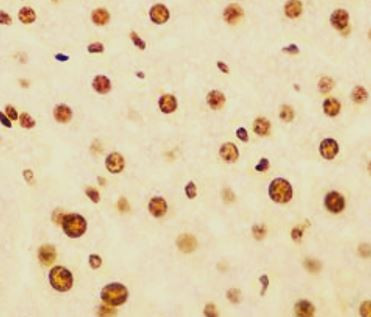 Anti-AGO2 / Argonaute 2