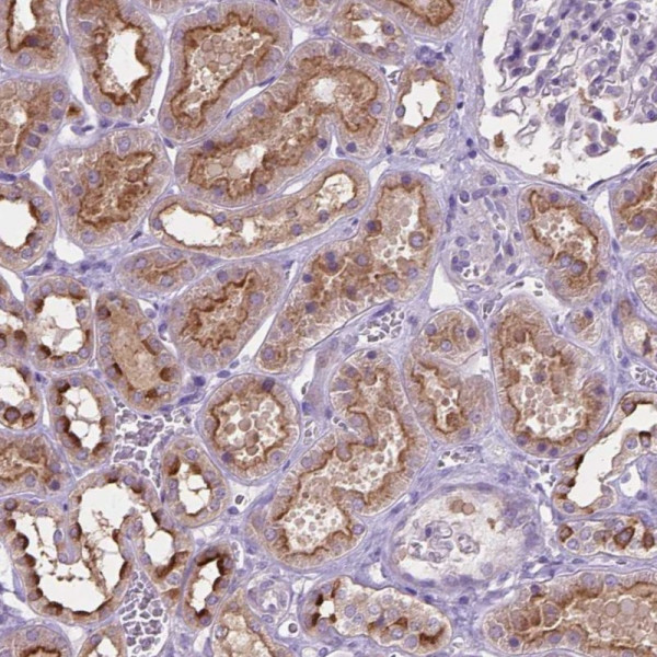 Anti-CDH7