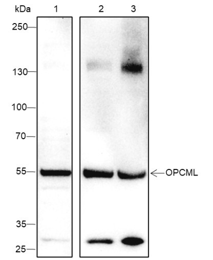 Anti-Recombinant OPCML, clone A316