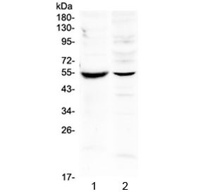 Anti-MMP16