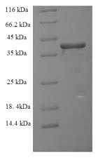 Ras-related protein Rab-6A (RAB6A), human, recombinant
