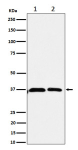 Anti-SRR / Serine racemase, clone 30S73