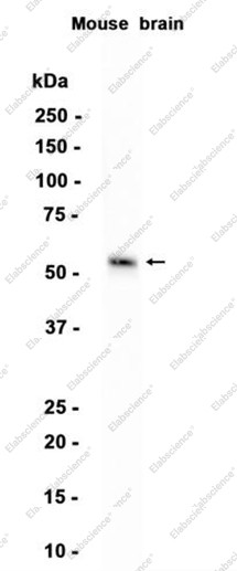 Anti-Recombinant MT4-MMP, clone C112932
