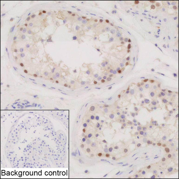 Anti-CNOT11