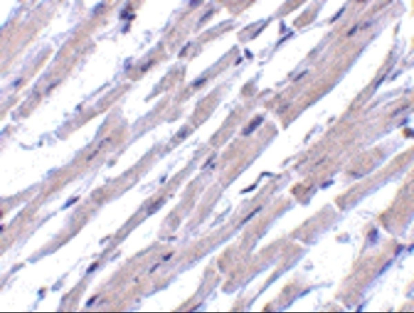 Anti-BCL2L13