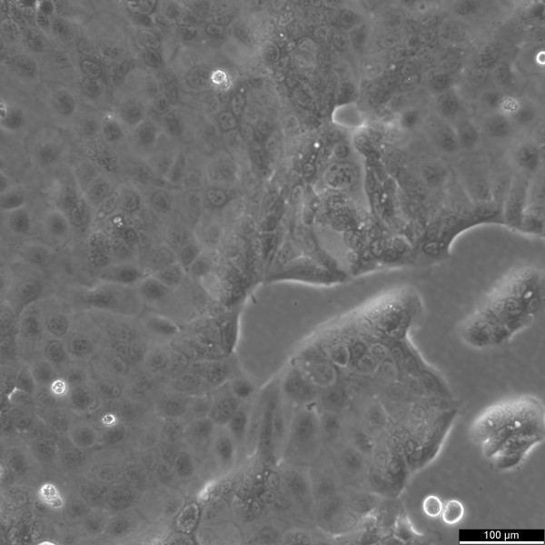 HPAF-II Cells
