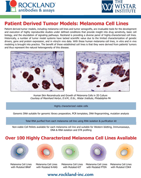  Patient-derived Tumor Models: Melanoma Cell Lines
