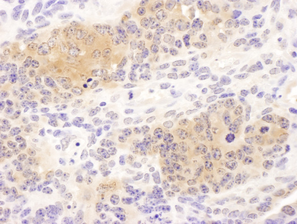 Anti-CCT8