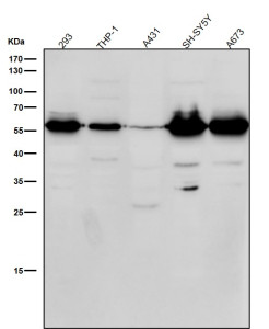 Anti-phospho-Beta Arrestin 1 (Ser412) / ARRB1, clone 32A60