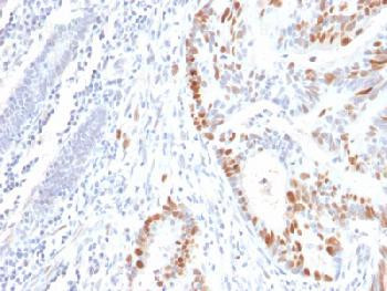 Anti-p53 Tumor Suppressor Protein Recombinant Mouse Monoclonal Antibody (clone:rBP53-12)