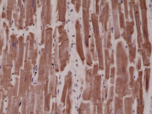 Anti-Desmin, Rabbit Monoclonal (RM234)