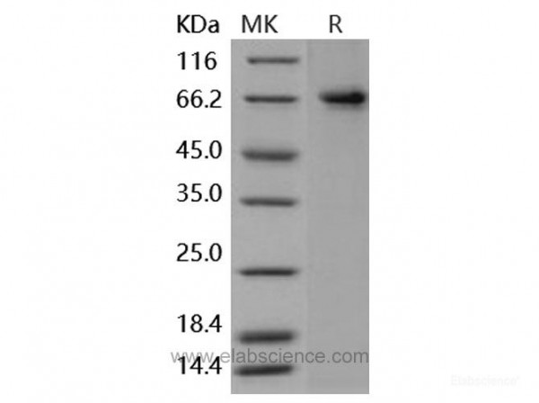 PTGS2 / COX2 / PGHS-2 Protein (His tag) (recombinant human)
