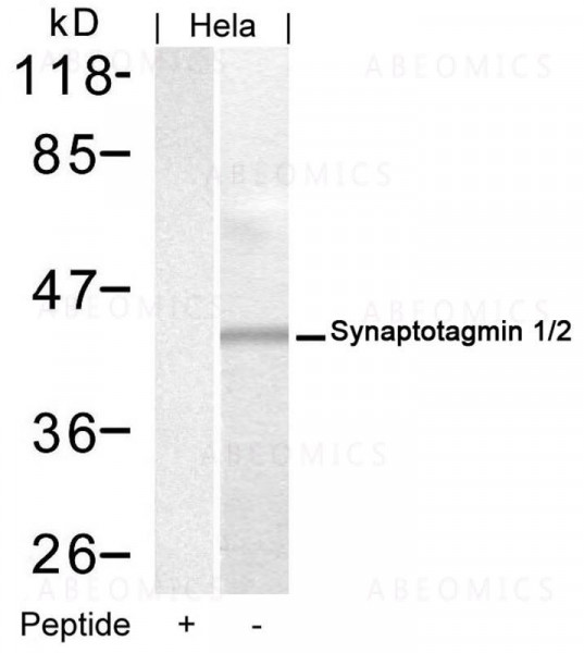 Anti-Synaptotagmin 1/2 (Ab-202/199)