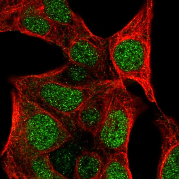 Anti-COLGALT2