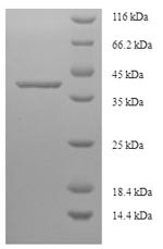 La-related protein 1B (LARP1B), human, recombinant
