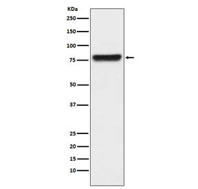 Anti-Plasma Kallikrein / KLKB1, clone ACDB-11