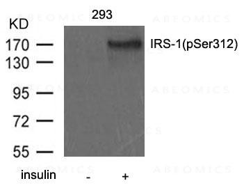 Anti-phospho-IRS-1(Ser312)
