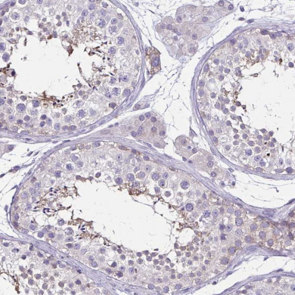 Anti-ULBP3