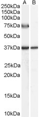 Anti-ACOX2 (Human), Internal