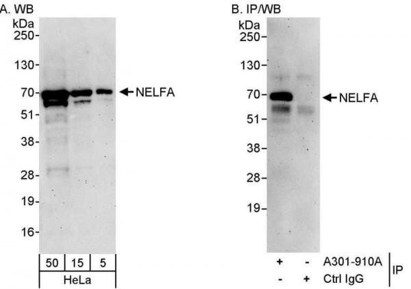 Anti-NELFA